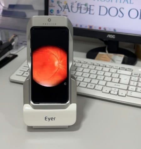 Retinógrafo digital exibindo imagem da retina